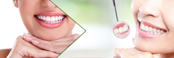dental braces and teetth whitening clinic mayur vihar phase 2