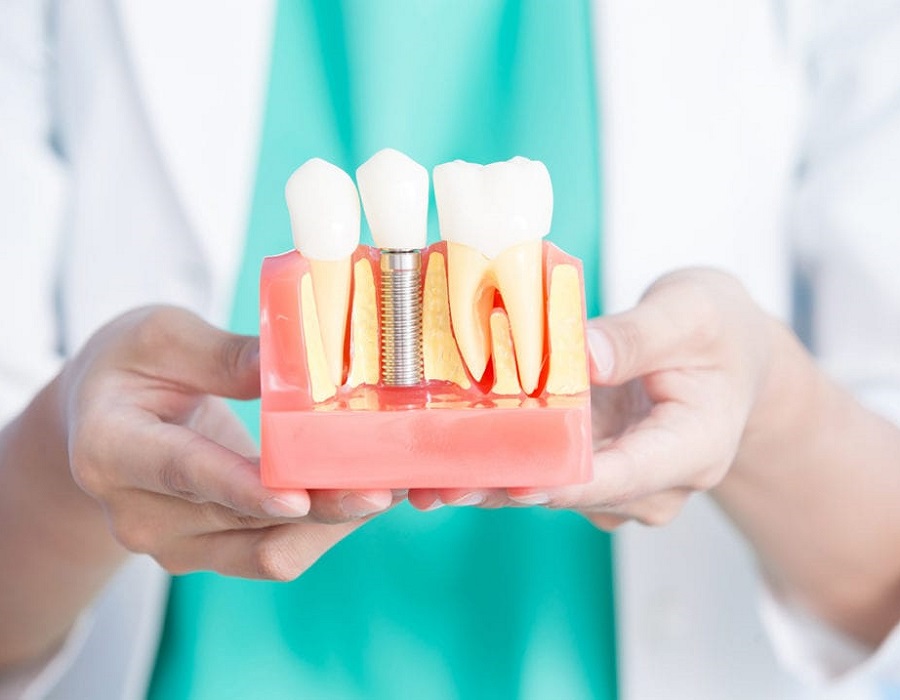 dental implant clinic near me